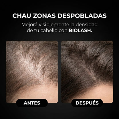 Sérum Capilar Elimina Entradas + Relleno de Zonas Despobladas