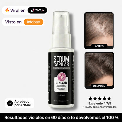 Sérum Capilar Elimina Entradas + Relleno de Zonas Despobladas